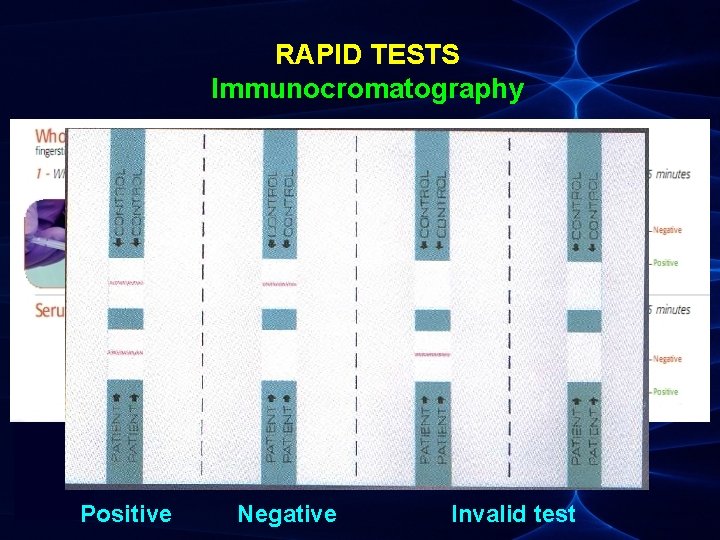 RAPID TESTS Immunocromatography Positive Negative Invalid test 