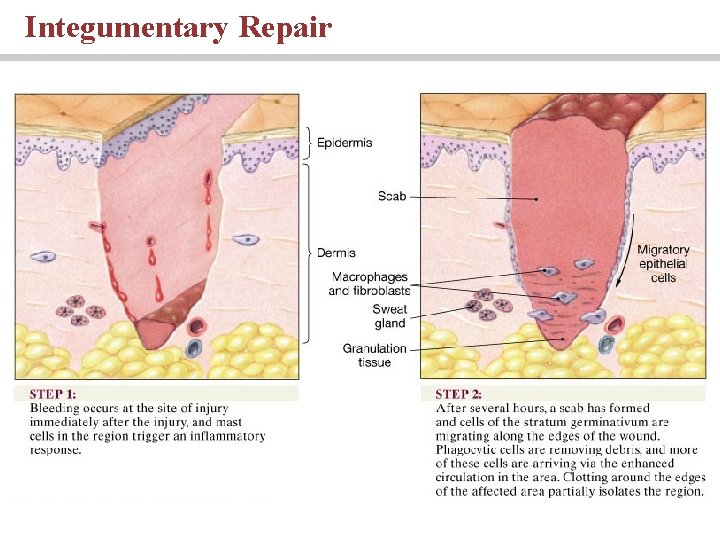 Integumentary Repair 