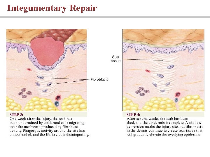 Integumentary Repair 