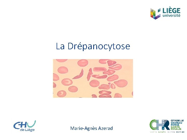 La Drépanocytose Marie-Agnès Azerad 