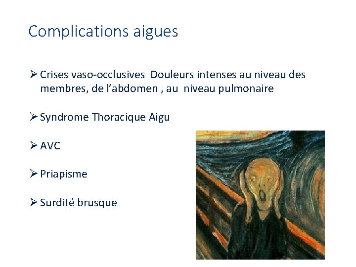 Complications aigues Ø Crises vaso-occlusives Douleurs intenses au niveau des membres, de l’abdomen ,