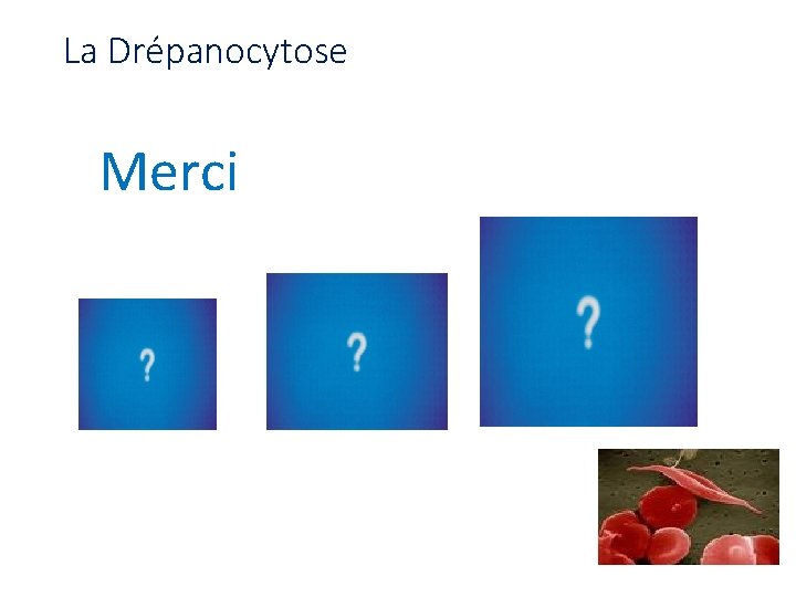 La Drépanocytose Merci 