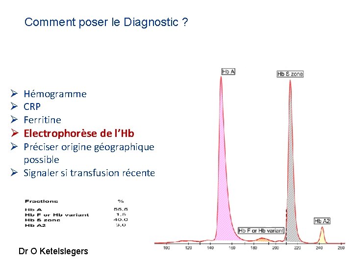 Comment poser le Diagnostic ? Ø Hémogramme Ø CRP Ø Ferritine Ø Electrophorèse de