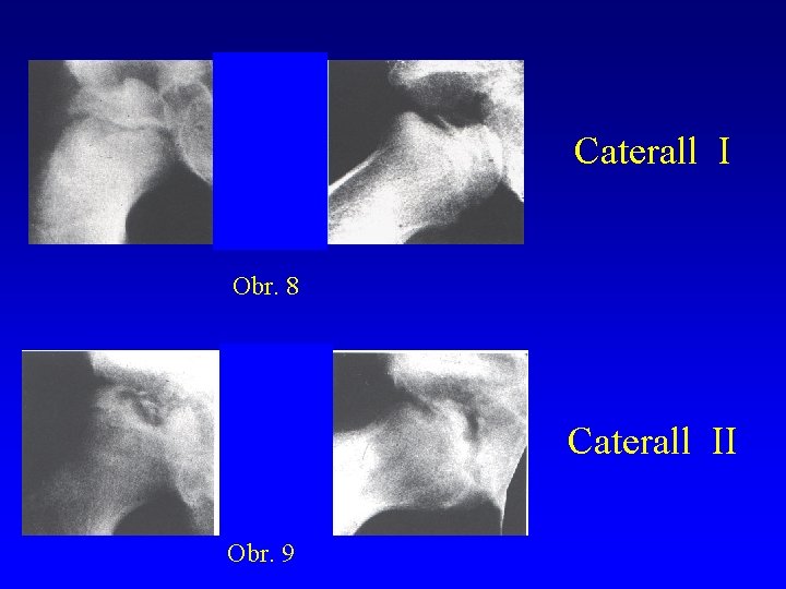 Caterall I Obr. 8 Caterall II Obr. 9 