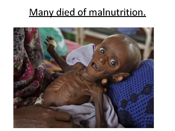 Many died of malnutrition. 
