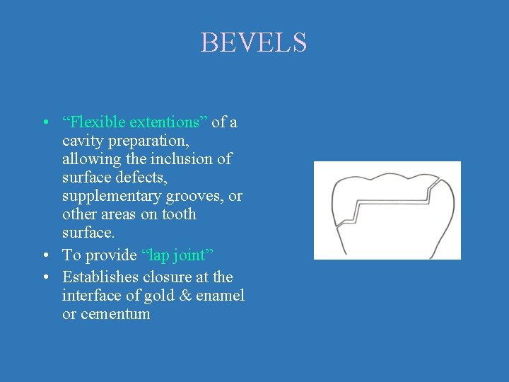 BEVELS • “Flexible extentions” of a cavity preparation, allowing the inclusion of surface defects,