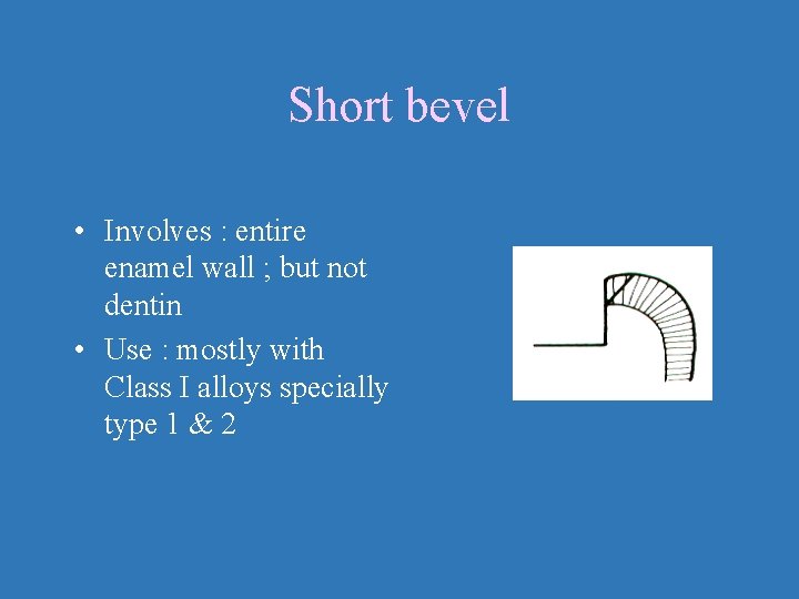 Short bevel • Involves : entire enamel wall ; but not dentin • Use