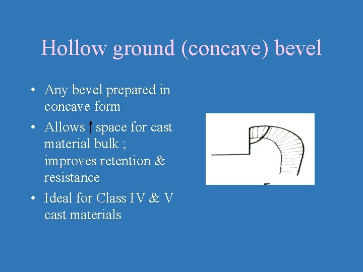 Hollow ground (concave) bevel • Any bevel prepared in concave form • Allows space