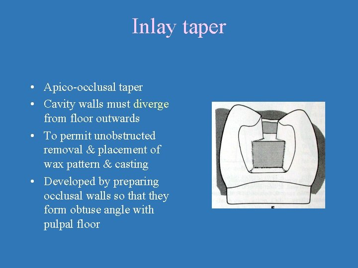 Inlay taper • Apico-occlusal taper • Cavity walls must diverge from floor outwards •