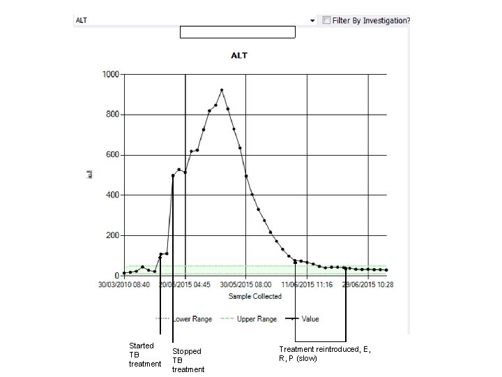 Started TB treatment Stopped TB treatment Treatment reintroduced, E, R, P (slow) 