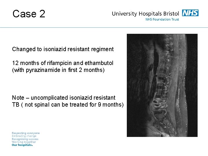 Case 2 Changed to isoniazid resistant regiment 12 months of rifampicin and ethambutol (with