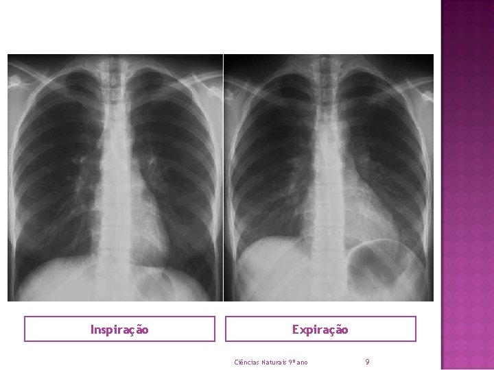 Inspiração Expiração Ciências Naturais 9º ano 9 