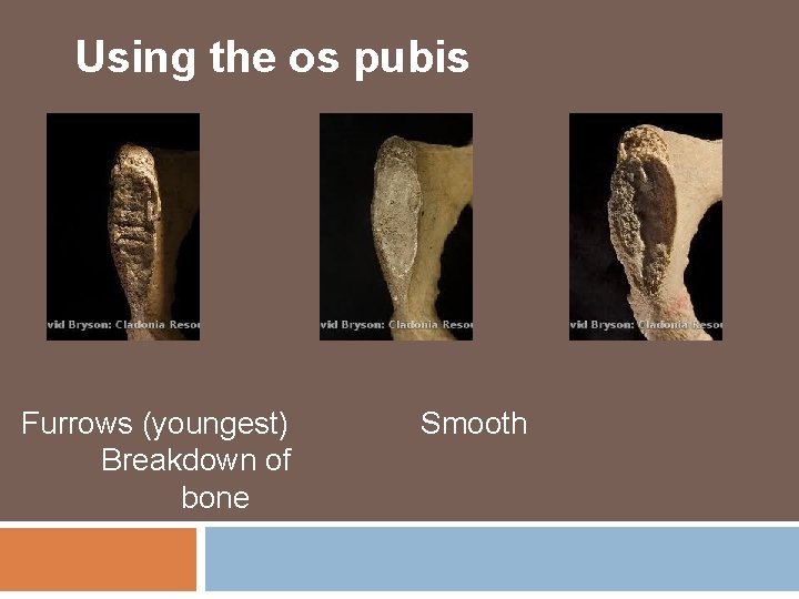 Using the os pubis Furrows (youngest) Breakdown of bone Smooth Using the os pubis Furrows (youngest) Breakdown of bone Smooth