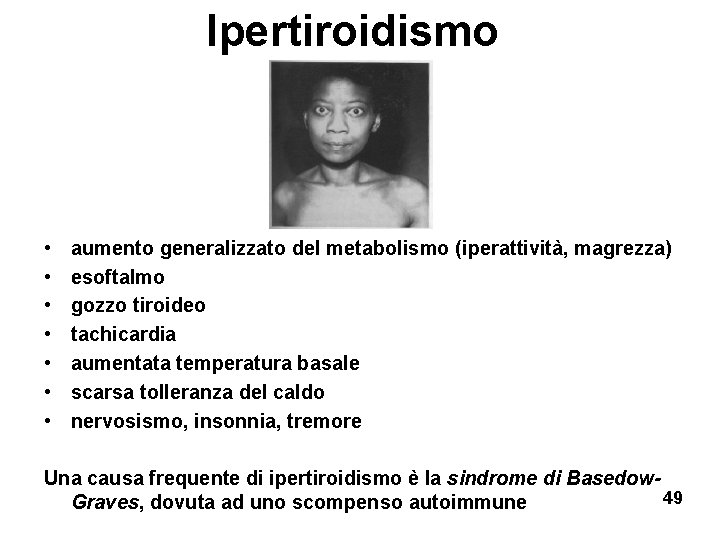 Ipertiroidismo • • aumento generalizzato del metabolismo (iperattività, magrezza) esoftalmo gozzo tiroideo tachicardia aumentata