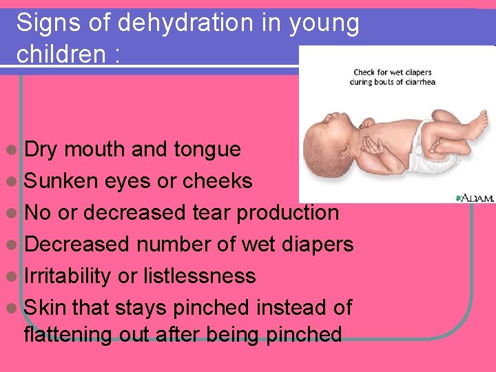 Signs of dehydration in young children : l Dry mouth and tongue l Sunken Signs of dehydration in young children : l Dry mouth and tongue l Sunken