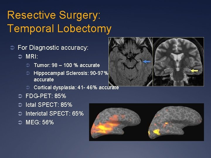 Resective Surgery: Temporal Lobectomy Ü For Diagnostic accuracy: Ü MRI: Ü Tumor: 98 –