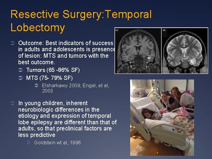 Resective Surgery: Temporal Lobectomy Ü Outcome: Best indicators of success in adults and adolescents