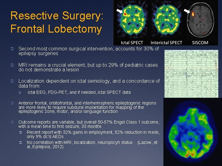 Resective Surgery: Frontal Lobectomy Ü Second most common surgical intervention, accounts for 30% of