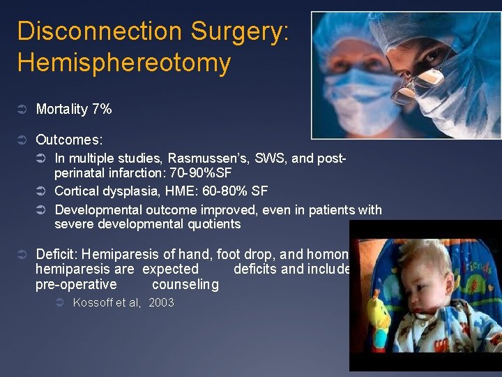 Disconnection Surgery: Hemisphereotomy Ü Mortality 7% Ü Outcomes: Ü In multiple studies, Rasmussen’s, SWS,