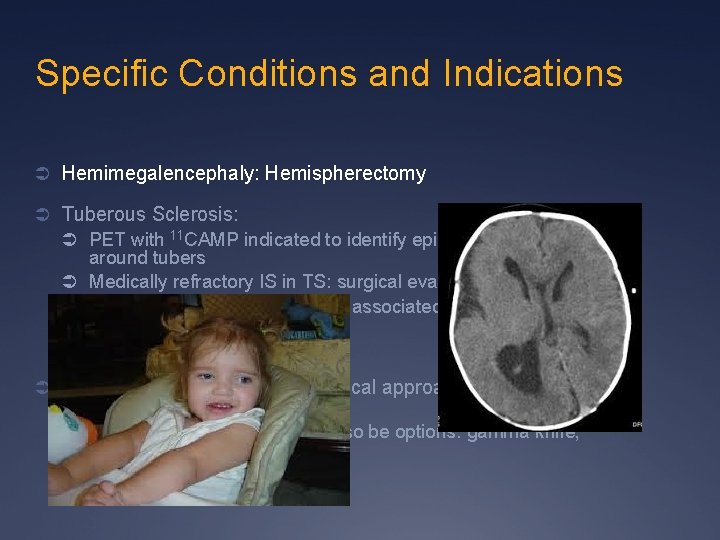 Specific Conditions and Indications Ü Hemimegalencephaly: Hemispherectomy Ü Tuberous Sclerosis: Ü PET with 11