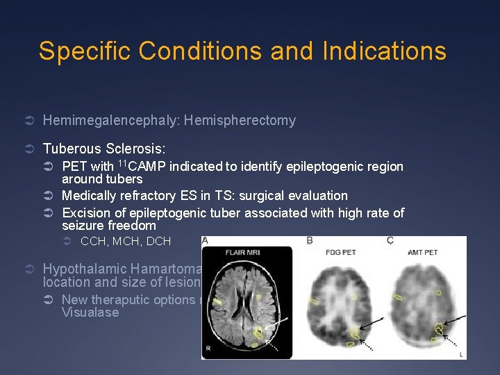 Specific Conditions and Indications Ü Hemimegalencephaly: Hemispherectomy Ü Tuberous Sclerosis: Ü PET with 11