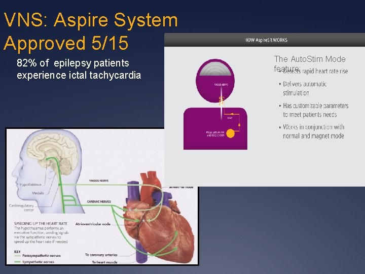 VNS: Aspire System Approved 5/15 82% of epilepsy patients experience ictal tachycardia The Auto.