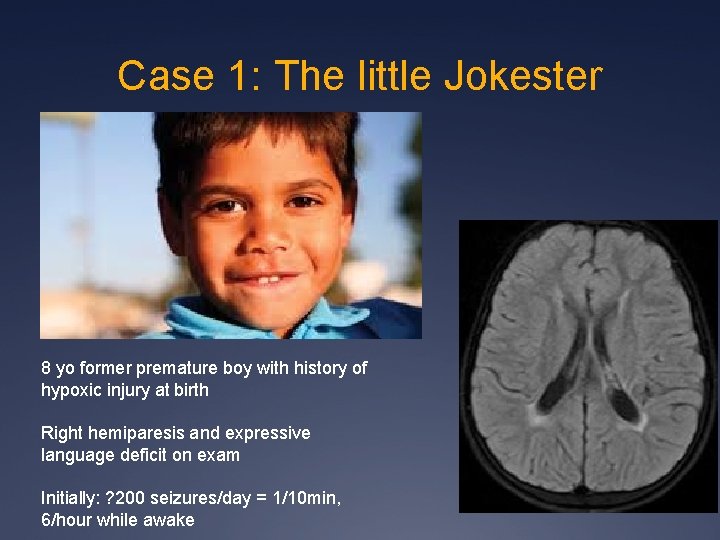 Case 1: The little Jokester 8 yo former premature boy with history of hypoxic