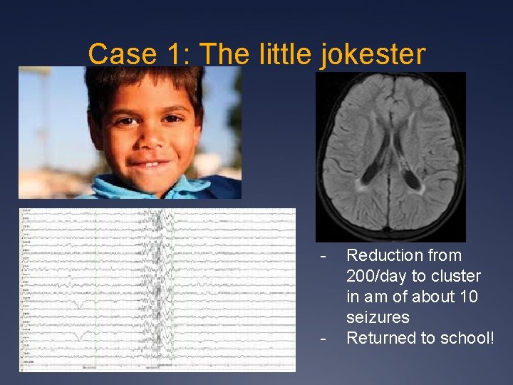 Case 1: The little jokester - - Reduction from 200/day to cluster in am