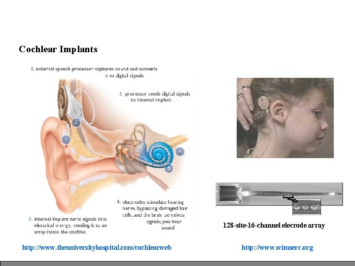 Cochlear Implants 128 -site-16 -channel elecrode array http: //www. theuniversityhospital. com/cochlearweb http: //www. wimserc. Cochlear Implants 128 -site-16 -channel elecrode array http: //www. theuniversityhospital. com/cochlearweb http: //www. wimserc.