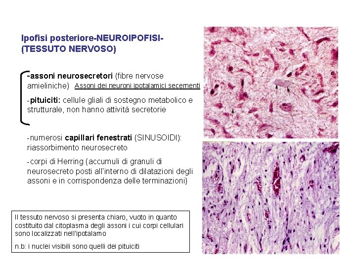 Ipofisi posteriore-NEUROIPOFISI(TESSUTO NERVOSO) -assoni neurosecretori (fibre nervose amieliniche) Assoni dei neuroni ipotalamici secernenti -pituiciti: