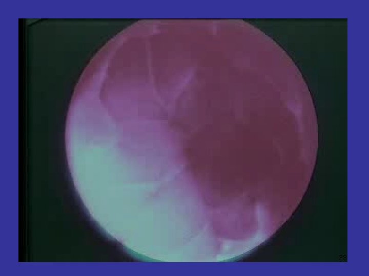 33 33