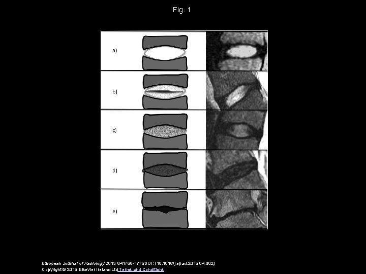 Fig. 1 European Journal of Radiology 2015 841768 -1776 DOI: (10. 1016/j. ejrad. 2015.