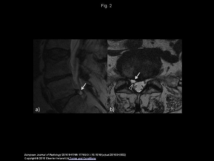 Fig. 2 European Journal of Radiology 2015 841768 -1776 DOI: (10. 1016/j. ejrad. 2015.