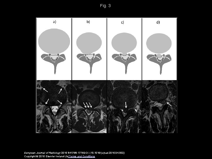 Fig. 3 European Journal of Radiology 2015 841768 -1776 DOI: (10. 1016/j. ejrad. 2015.