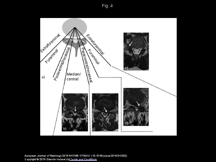 Fig. 4 European Journal of Radiology 2015 841768 -1776 DOI: (10. 1016/j. ejrad. 2015.