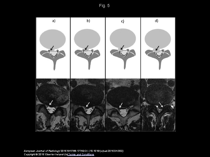 Fig. 5 European Journal of Radiology 2015 841768 -1776 DOI: (10. 1016/j. ejrad. 2015.