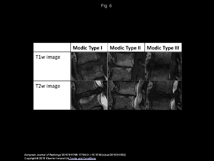Fig. 6 European Journal of Radiology 2015 841768 -1776 DOI: (10. 1016/j. ejrad. 2015.