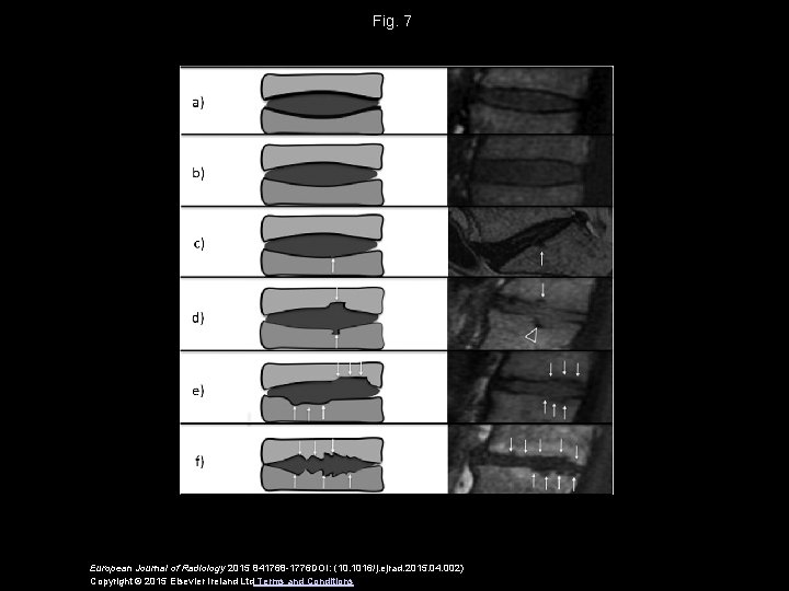 Fig. 7 European Journal of Radiology 2015 841768 -1776 DOI: (10. 1016/j. ejrad. 2015.