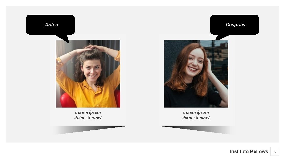 Antes Después Lorem ipsum dolor sit amet Instituto Bellows 5 