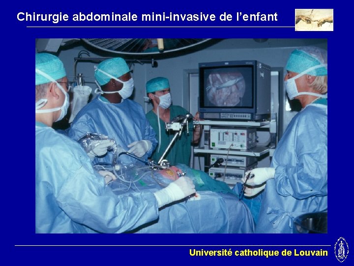 Chirurgie abdominale mini-invasive de l’enfant Université catholique de Louvain 