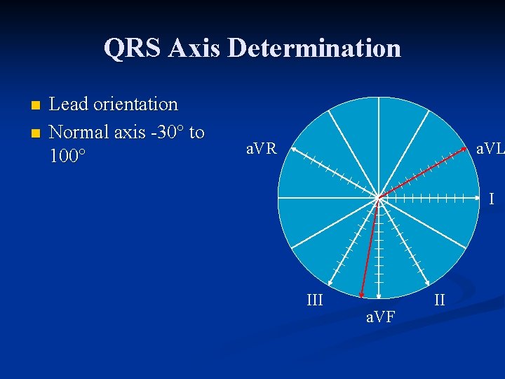 QRS Axis Determination n n Lead orientation Normal axis 30° to 100° a. VR