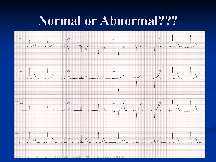 Normal or Abnormal? ? ? 