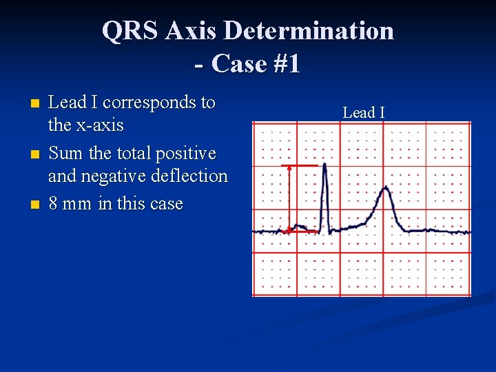 QRS Axis Determination - Case #1 n n n Lead I corresponds to the