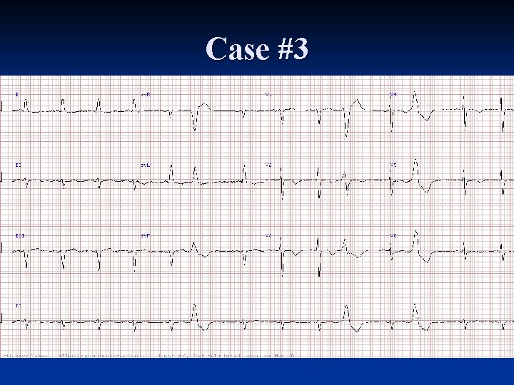 Case #3 