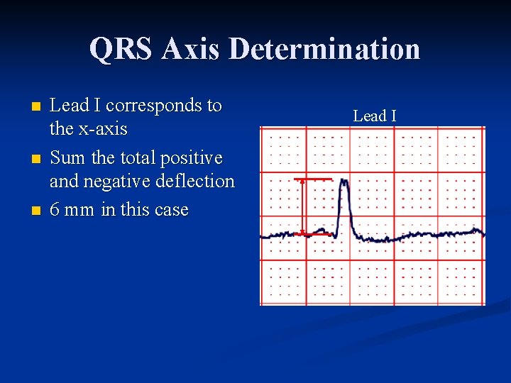 QRS Axis Determination n Lead I corresponds to the x axis Sum the total