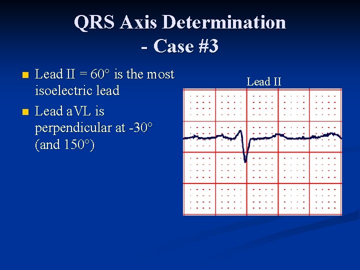 QRS Axis Determination - Case #3 n n Lead II = 60° is the