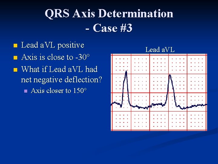 QRS Axis Determination - Case #3 n n n Lead a. VL positive Axis