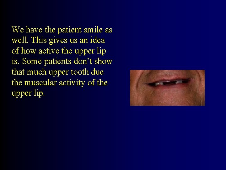 We have the patient smile as well. This gives us an idea of how