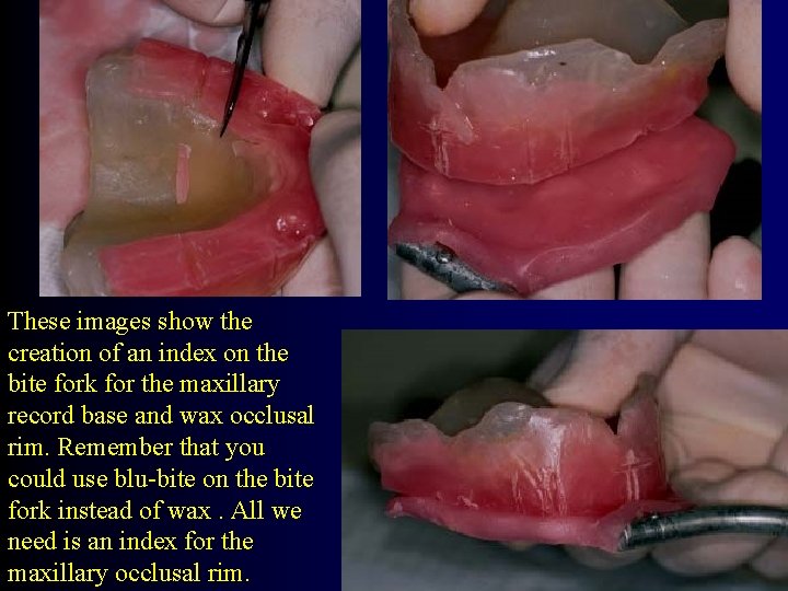 These images show the creation of an index on the bite fork for the