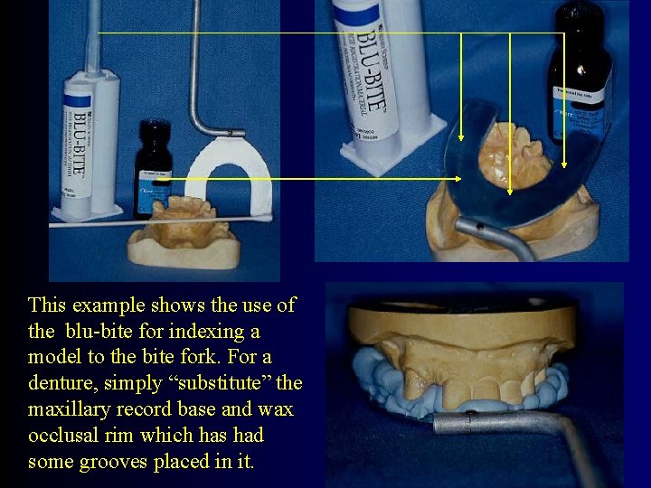 This example shows the use of the blu-bite for indexing a model to the